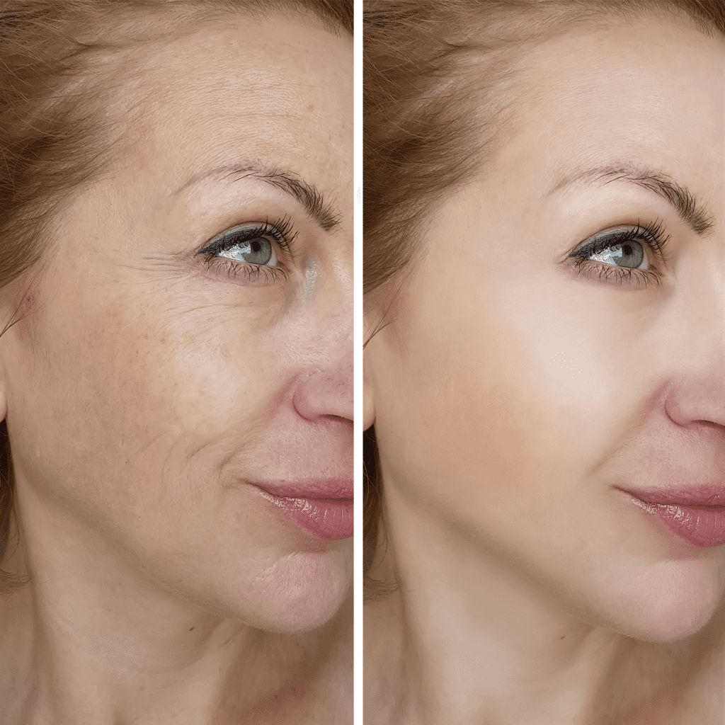 Masajeador Facial Reductor Luz Led Recar